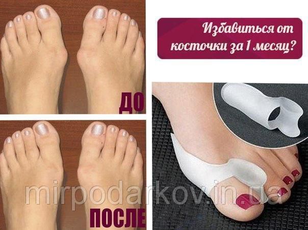 Фиксатор на палец Valgus Pro - фото фото фото 1