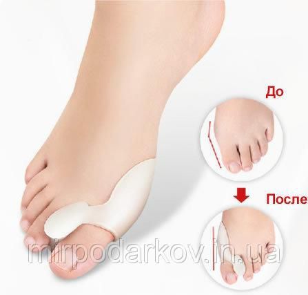 Фиксатор на палец Valgus Pro - фото фото фото 0