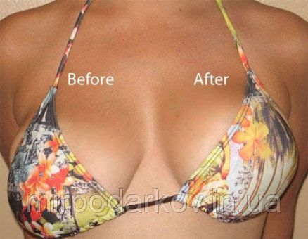 ПОЛНАЯ РАСПРОДАЖА!!!Bare lifts - Бюстгальтер-невидимка - фото фото фото 5
