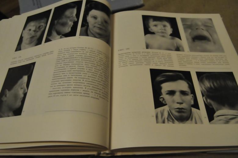 КНИГА АТЛАС ПЛАСТИЧЕСКОЙ ХИРУРГИИ 1967Г. 3 ТОМА - фото фото фото 4