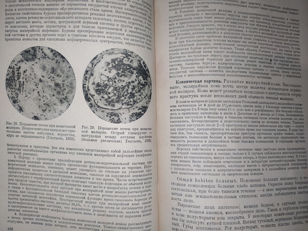 книга: КЛИНИКА МАЛЯРИИ. II-е изд. 1946г.; - фото фото фото 5