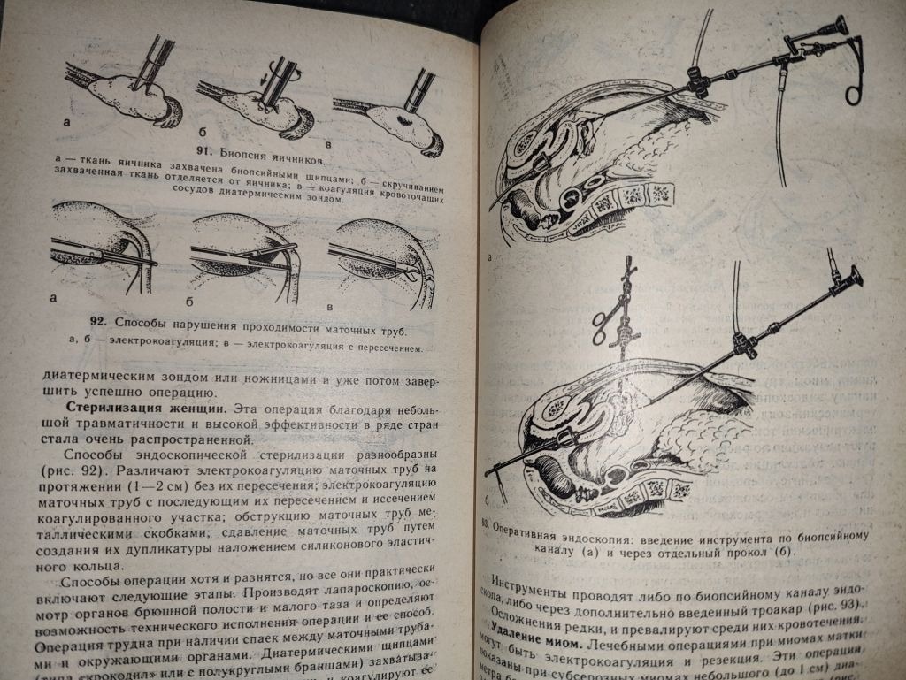 книга: ЭНДОСКОПИЯ 1987г. - фото фото фото 10