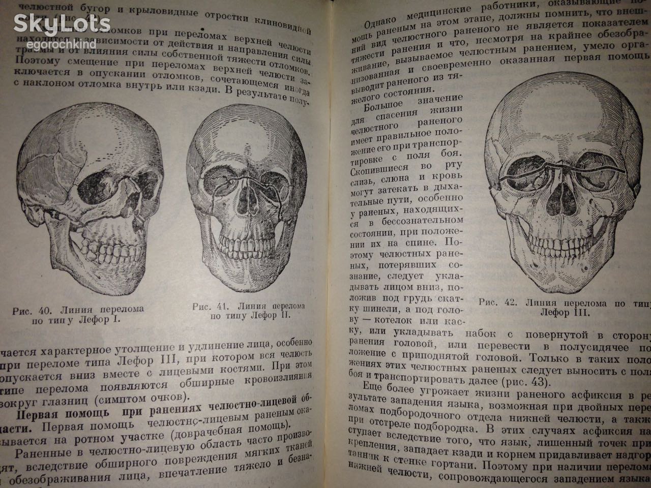 книга: БОЛЕЗНИ ЗУБОВ, ЧЕЛЮСТЕЙ И РТА 1949г. - фото фото фото 9