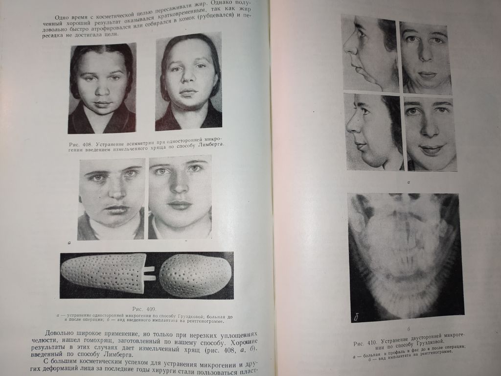 книга: ВОССТАНОВИТЕЛЬНЫЕ ОПЕРАЦИИ ЧЕЛЮСТНО-ЛИЦЕВОЙ ОБЛАСТИ 1962г. - фото фото фото 7