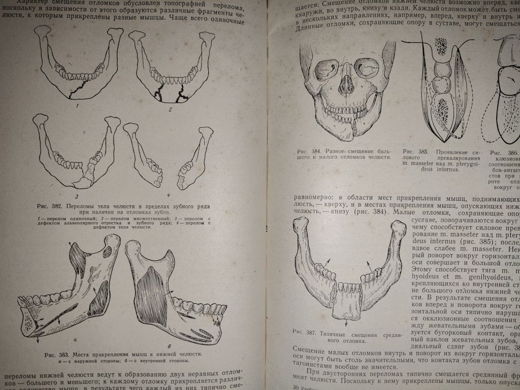 книга: УЧЕБНИК ОРТОПЕДИЧЕСКОЙ СТОМАТОЛОГИИ, II-е изд., 1962г. - фото фото фото 12