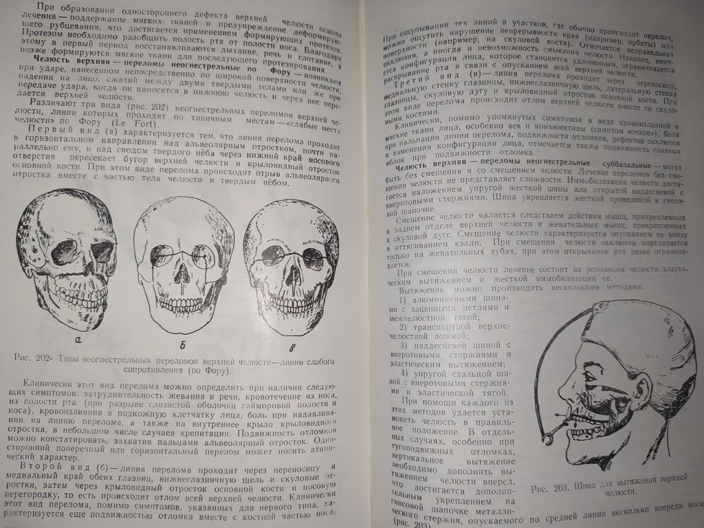 книга: СЛОВАРЬ-СПРАВОЧНИК ПО ОРТОПЕДИЧЕСКОЙ СТОМАТОЛОГИИ 1970г. - фото фото фото 12