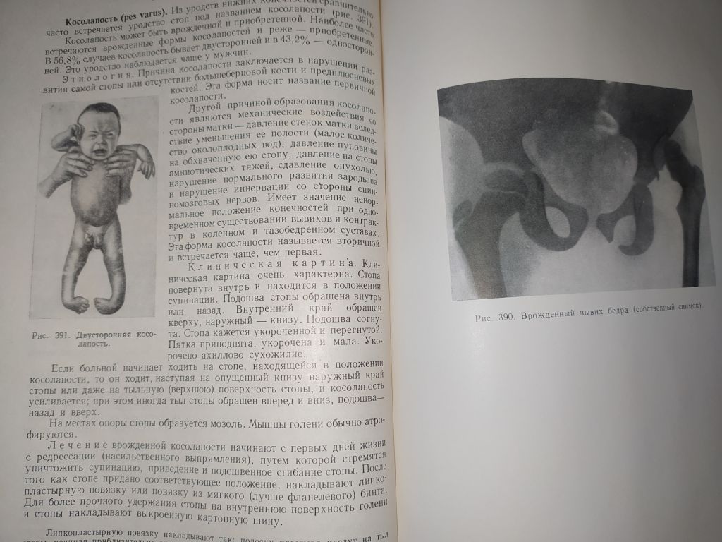 книга: ХИРУРГИЯ. VIII-е изд. 1958г. - фото фото фото 8