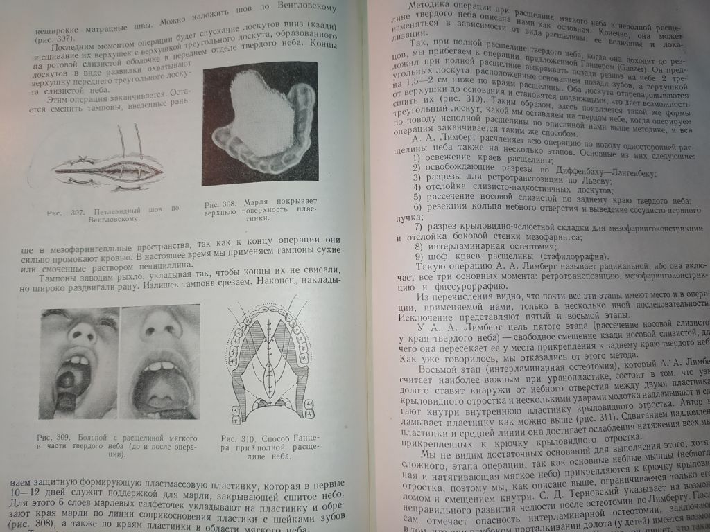книга: ВОССТАНОВИТЕЛЬНЫЕ ОПЕРАЦИИ ЧЕЛЮСТНО-ЛИЦЕВОЙ ОБЛАСТИ 1962г. - фото фото фото 13