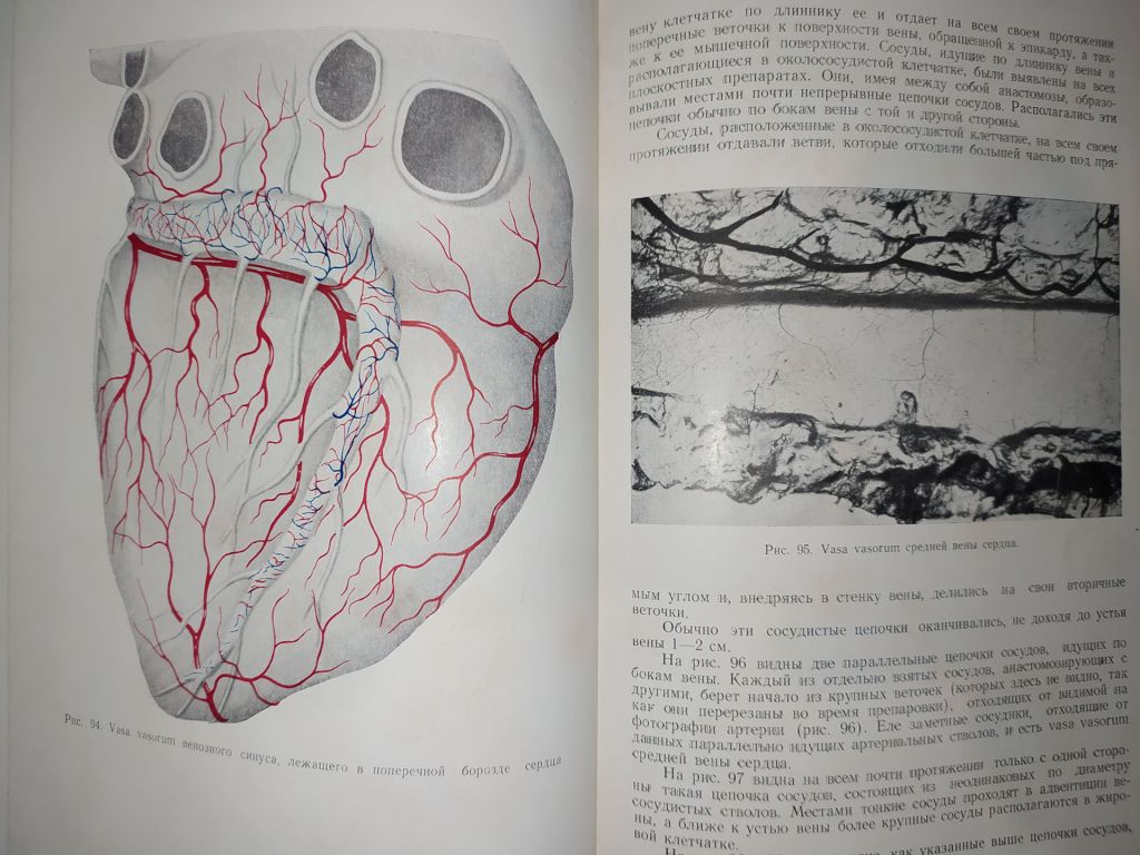 книга: КРОВЕНОСНЫЕ СОСУДЫ СЕРДЦА В НОРМЕ И ПАТОЛОГИИ 1954г. - фото фото фото 6