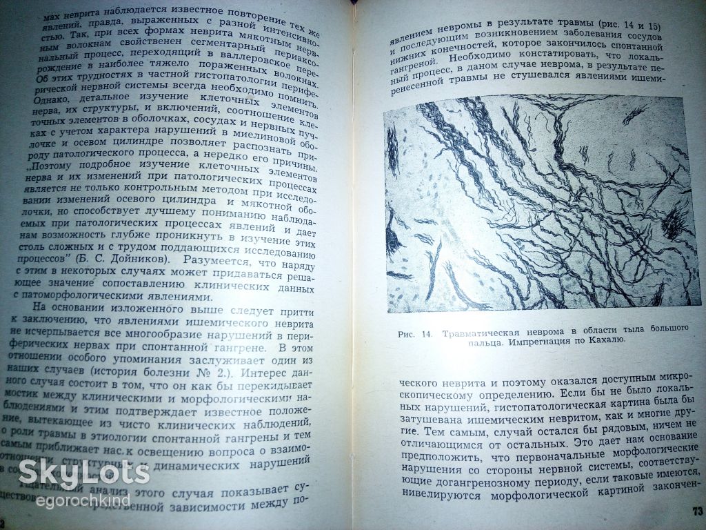 книга: ИШЕМИЧЕСКИЕ ЗАБОЛЕВАНИЯ НЕРВНЫХ СТВОЛОВ 1945г.; - фото фото фото 7