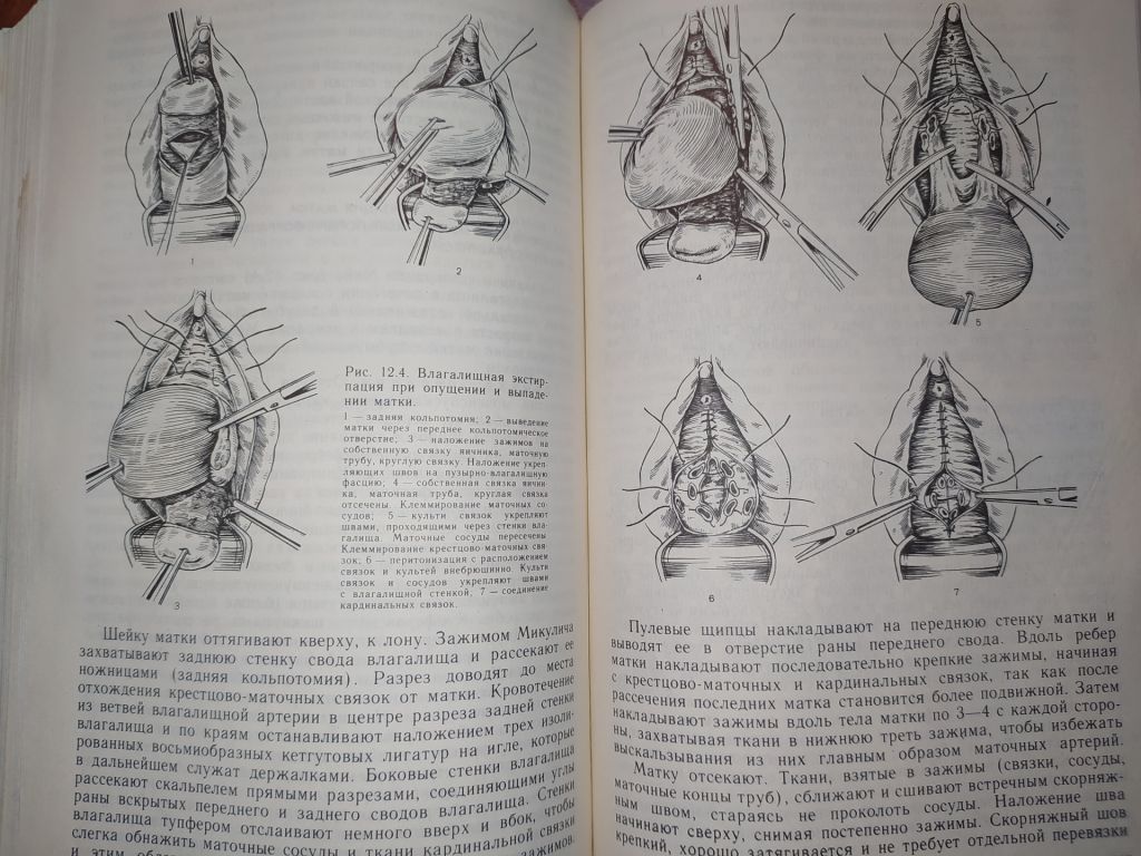 книга: ОПЕРАТИВНАЯ ГИНЕКОЛОГИЯ. Руководство для врачей 1990г. - фото фото фото 5