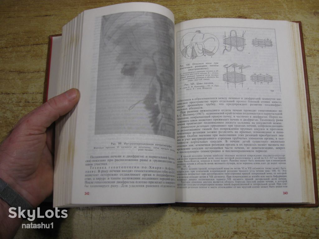 неотложная хирургия детей 1983 - фото фото фото 5