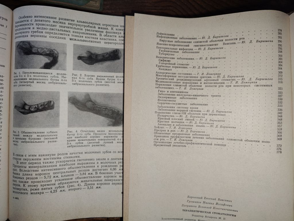 книги: ПРОБЛЕМЫ ТЕРАПЕВТИЧЕСКОЙ СТОМАТОЛОГИИ, выпуск 2, 1967. ТЕРАПЕВТИЧЕСКАЯ СТОМАТОЛОГИЯ, II-е изд.,1973 - фото фото фото 5