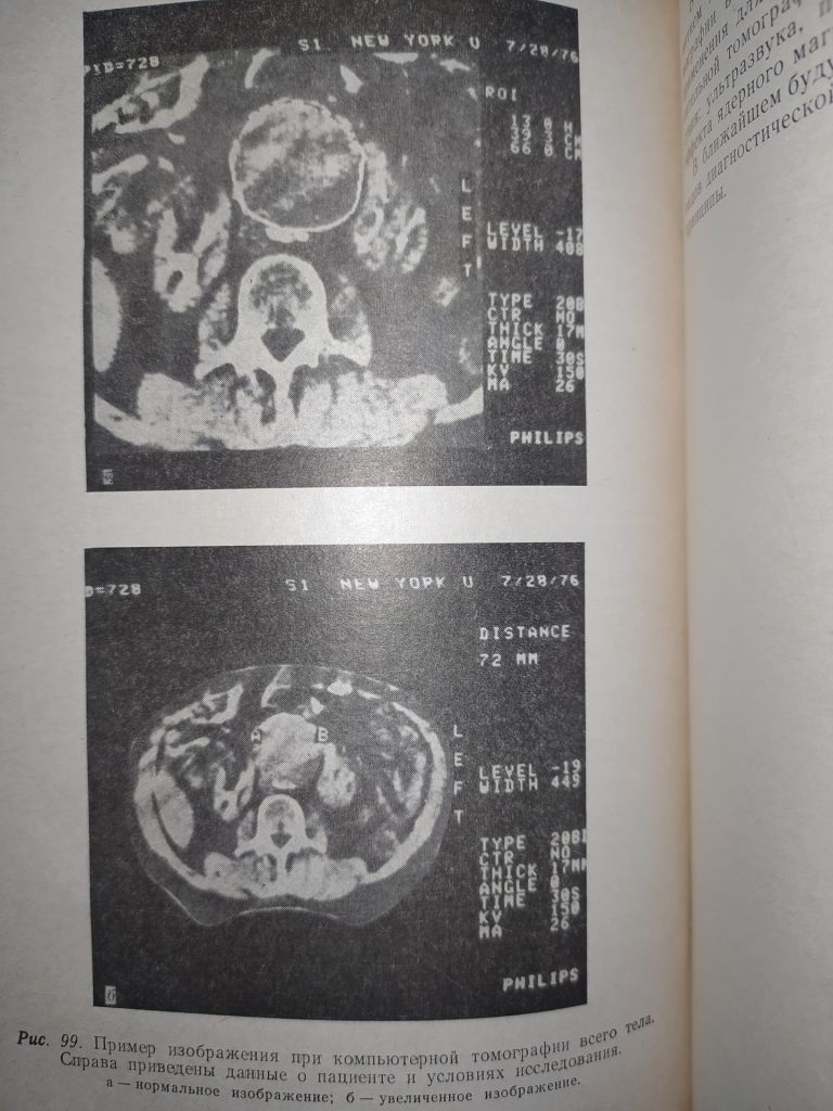 книга: ТЕХНИЧЕСКИЕ СРЕДСТВА РЕНТГЕНОДИАГНОСТИКИ 1981г. - фото фото фото 10