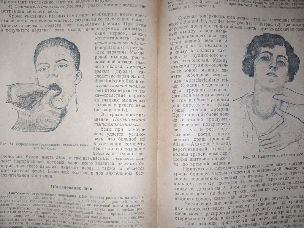книга: МЕТОДИКА ИССЛЕДОВАНИЯ ХИРУРГИЧЕСКОГО БОЛЬНОГО, II-е изд., 1938г. - фото фото фото 6