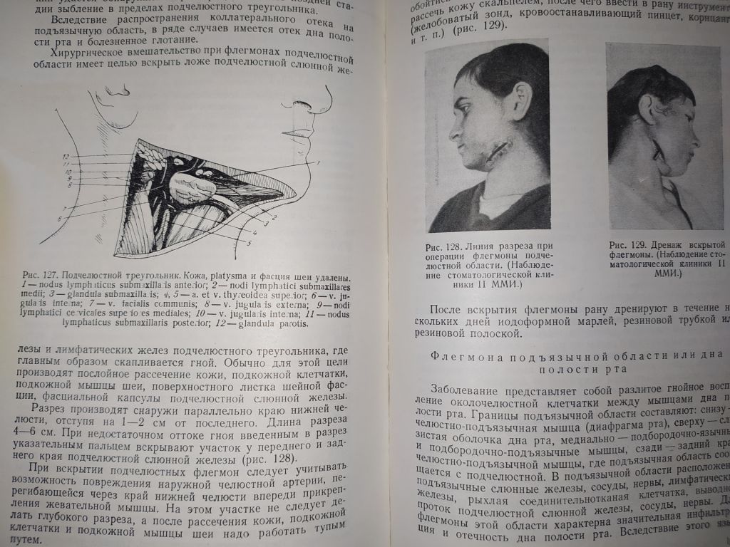 книга: СТОМАТОЛОГИЯ. II-е изд. авт.: И.М.Старобинский 1951г. - фото фото фото 8