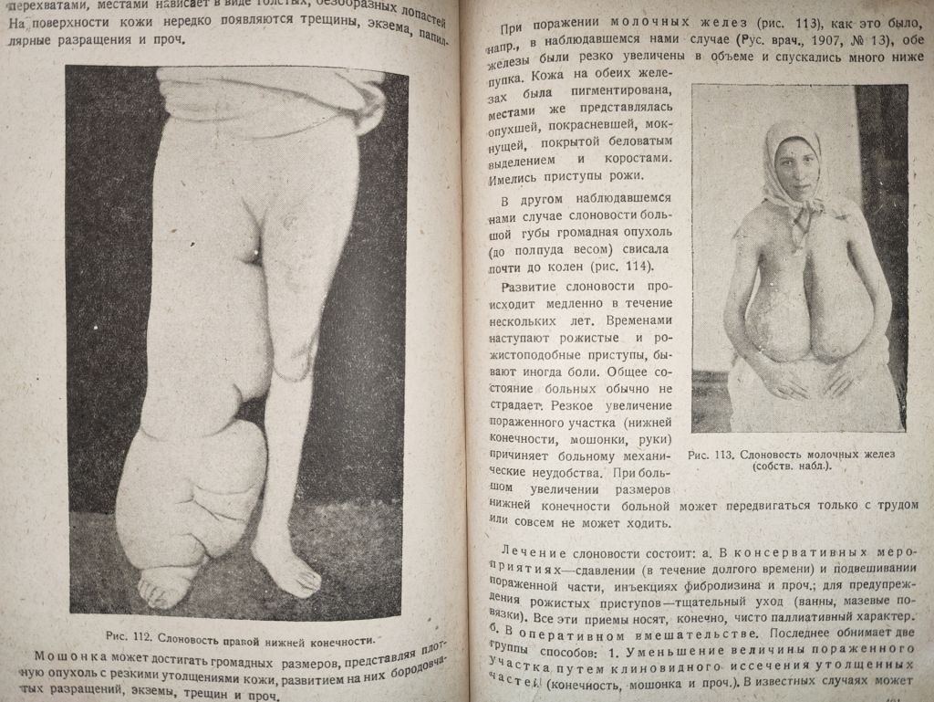 книга: ОСНОВЫ ОБЩЕЙ ХИРУРГИИ, том II, 1937г.; - фото фото фото 6