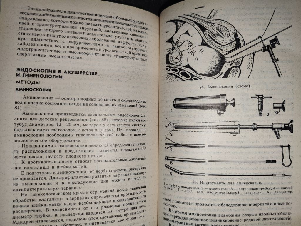 книга: ЭНДОСКОПИЯ 1987г. - фото фото фото 11