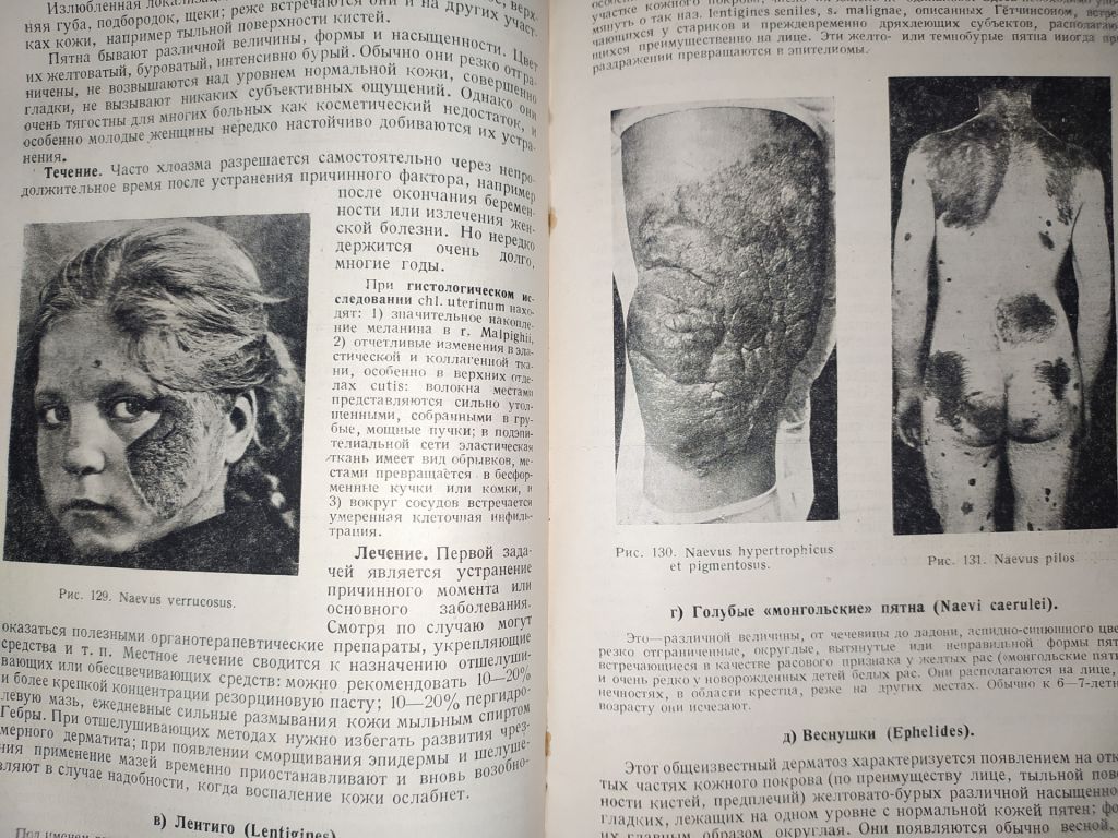 книга: УЧЕБНИК КОЖНЫХ БОЛЕЗНЕЙ 1933г. - фото фото фото 12