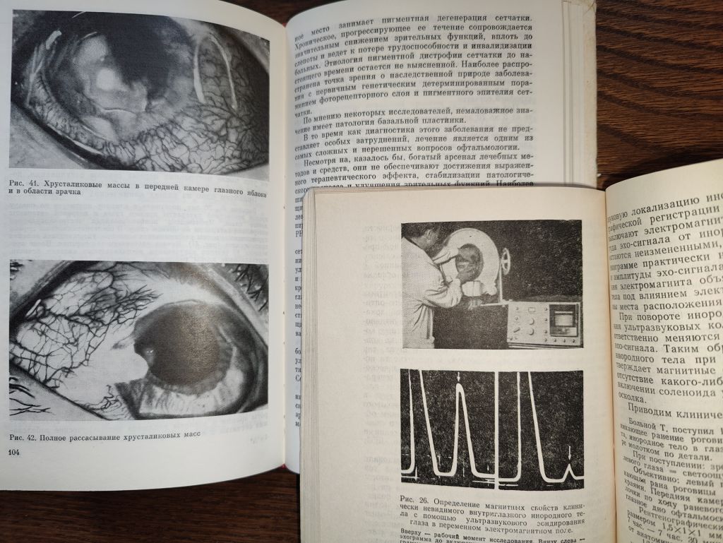книги: УЛЬТРАЗВУК В ОФТАЛЬМОЛОГИИ 1987г. УЛЬТРАЗВУК В ОФТАЛЬМОЛОГИИ 1973г. - фото фото фото 6