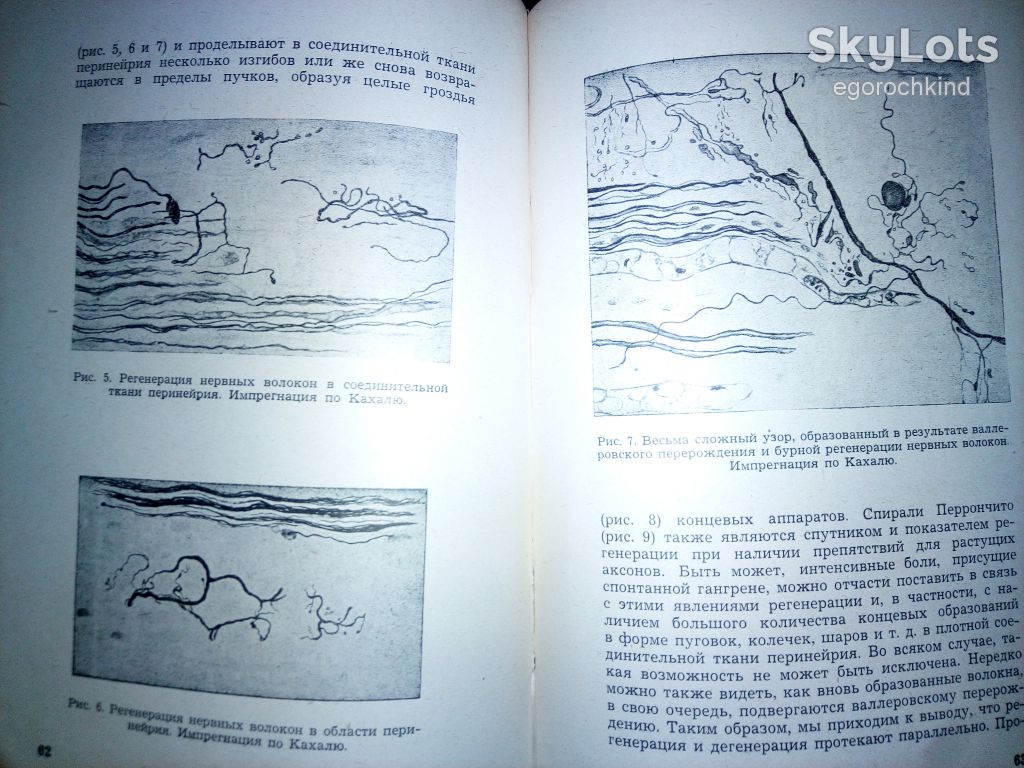 книга: ИШЕМИЧЕСКИЕ ЗАБОЛЕВАНИЯ НЕРВНЫХ СТВОЛОВ 1945г.; - фото фото фото 6