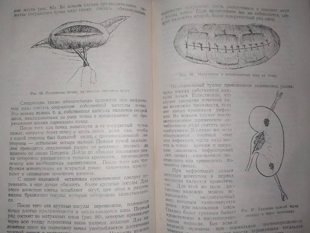 книга: ОЧЕРКИ ОПЕРАТИВНОЙ УРОЛОГИИ. II-e изд. 1959г. - фото фото фото 7