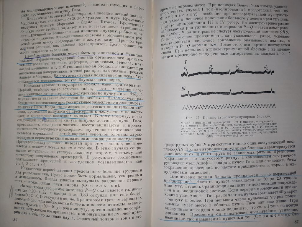 книга: БОЛЕЗНИ СЕРДЦА У ДЕТЕЙ. II-е изд. 1952г. - фото фото фото 6