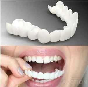 Виниры для зубов Snap On Smile 2 - фото фото фото 2