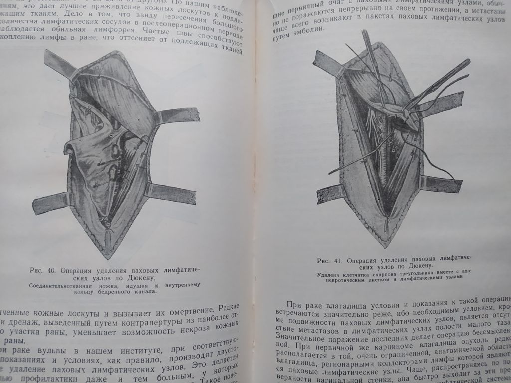 книга: РАК ВЛАГАЛИЩА. КЛИНИЧЕСКАЯ МОНОГРАФИЯ 1954г. - фото фото фото 6