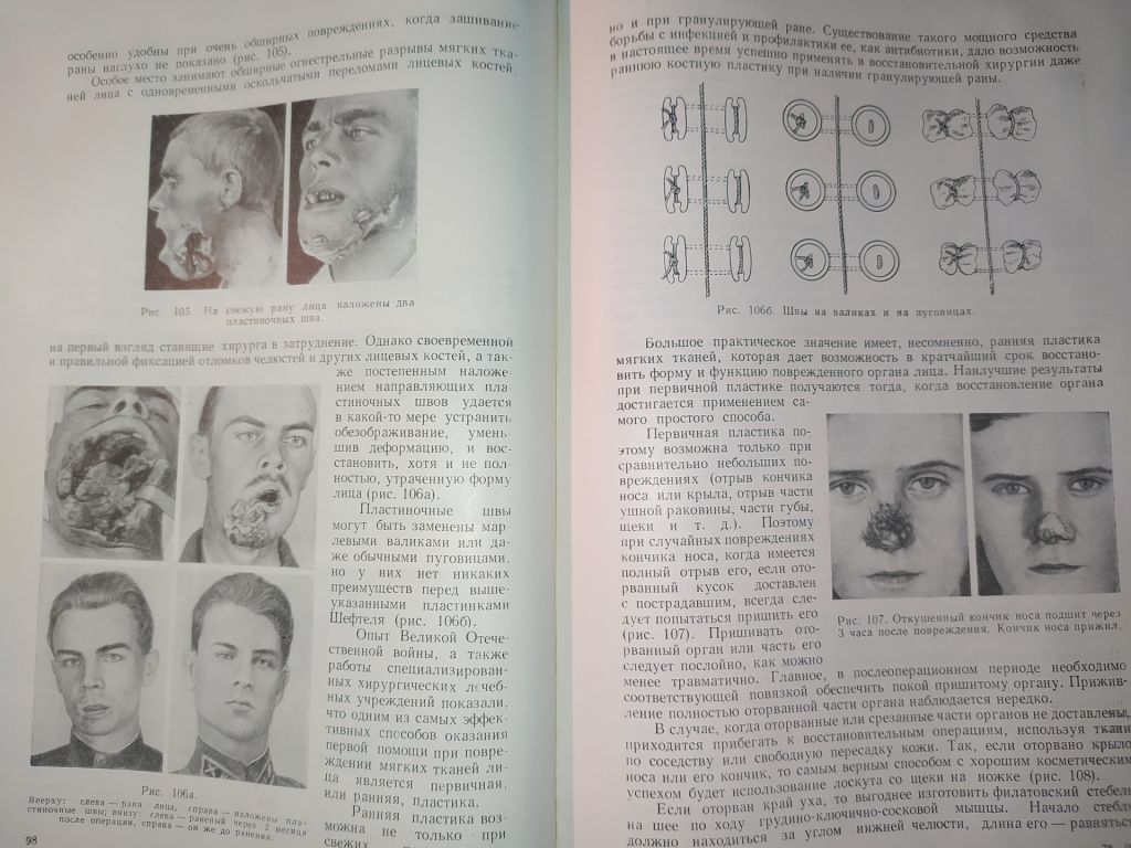 книга: ВОССТАНОВИТЕЛЬНЫЕ ОПЕРАЦИИ ЧЕЛЮСТНО-ЛИЦЕВОЙ ОБЛАСТИ 1962г. - фото фото фото 3