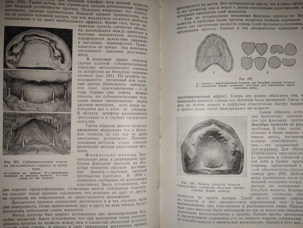 книга: УЧЕБНИК ОРТОПЕДИЧЕСКОЙ СТОМАТОЛОГИИ, II-е изд., 1962г. - фото фото фото 14