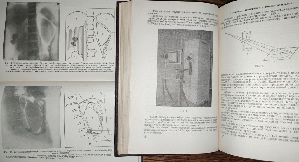 книга: НОВЫЕ МЕТОДЫ ДИАГНОСТИКИ В ОНКОЛОГИИ И РЕНТГЕНОЛОГИИ 1957г. - фото фото фото 5