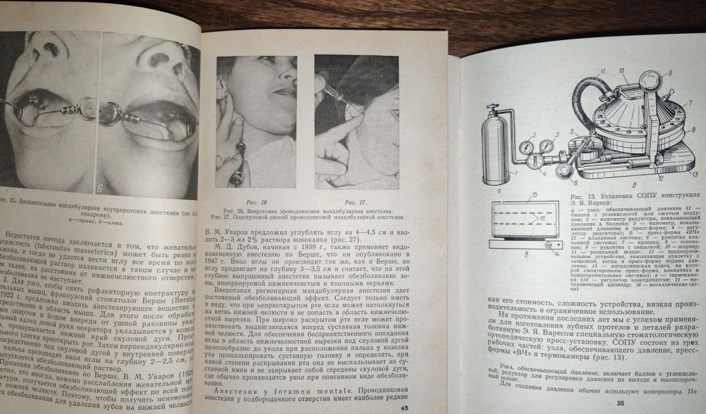 книги: УДАЛЕНИЕ ЗУБОВ, III-е изд., 1976. ЗАМЕЩАЮЩИЕ ПРОТЕЗЫ ВЕРХНЕЙ ЧЕЛЮСТИ 1981 - фото фото фото 6