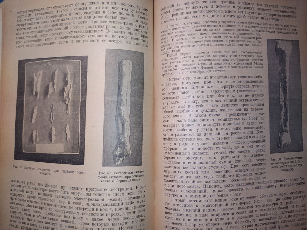 Книга: КУРС ОБЩЕЙ ХИРУРГИИ 1935г.; - фото фото фото 6