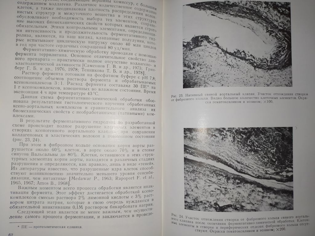 книга: БИОЛОГИЧЕСКИЕ ПРОТЕЗЫ КЛАПАНОВ СЕРДЦА 1988г. - фото фото фото 6
