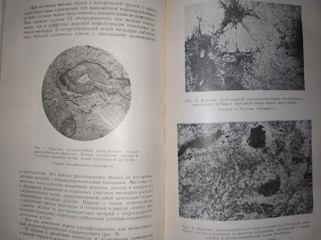 книга: АТЕРОСКЛЕРОЗ И КОРОНАРНАЯ НЕДОСТАТОЧНОСТЬ 1956г. - фото фото фото 7