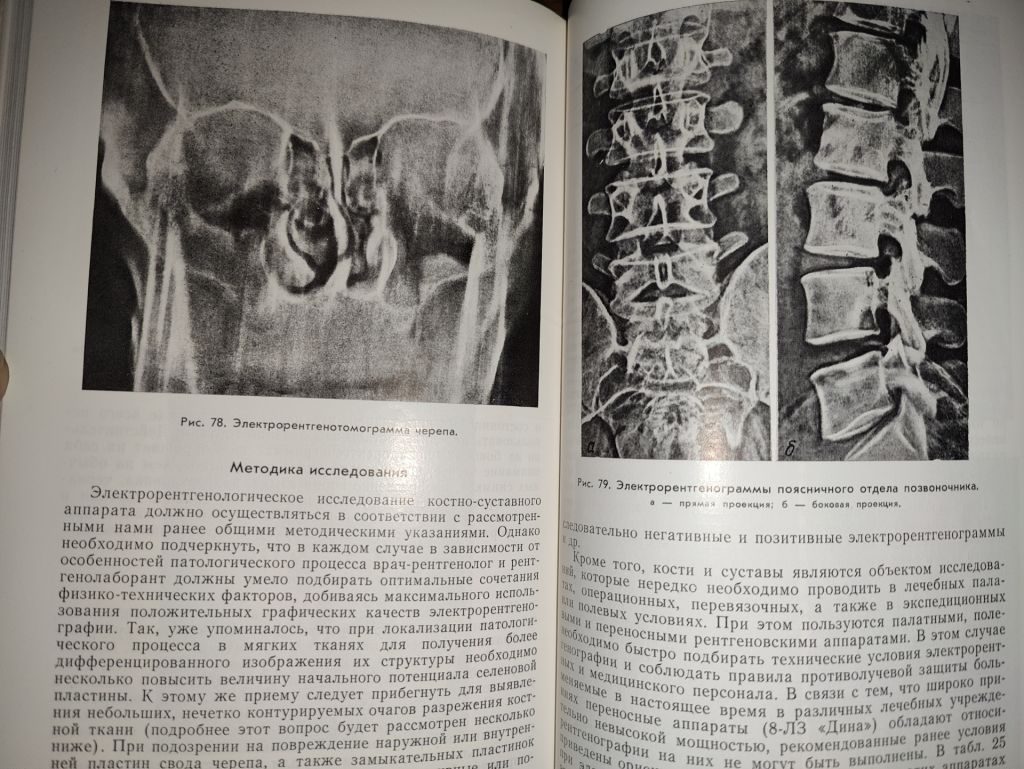 книга: МЕТОДИКА И ТЕХНИКА ЭЛЕКТРОРЕНТГЕНОГРАФИИ 1982г. - фото фото фото 6