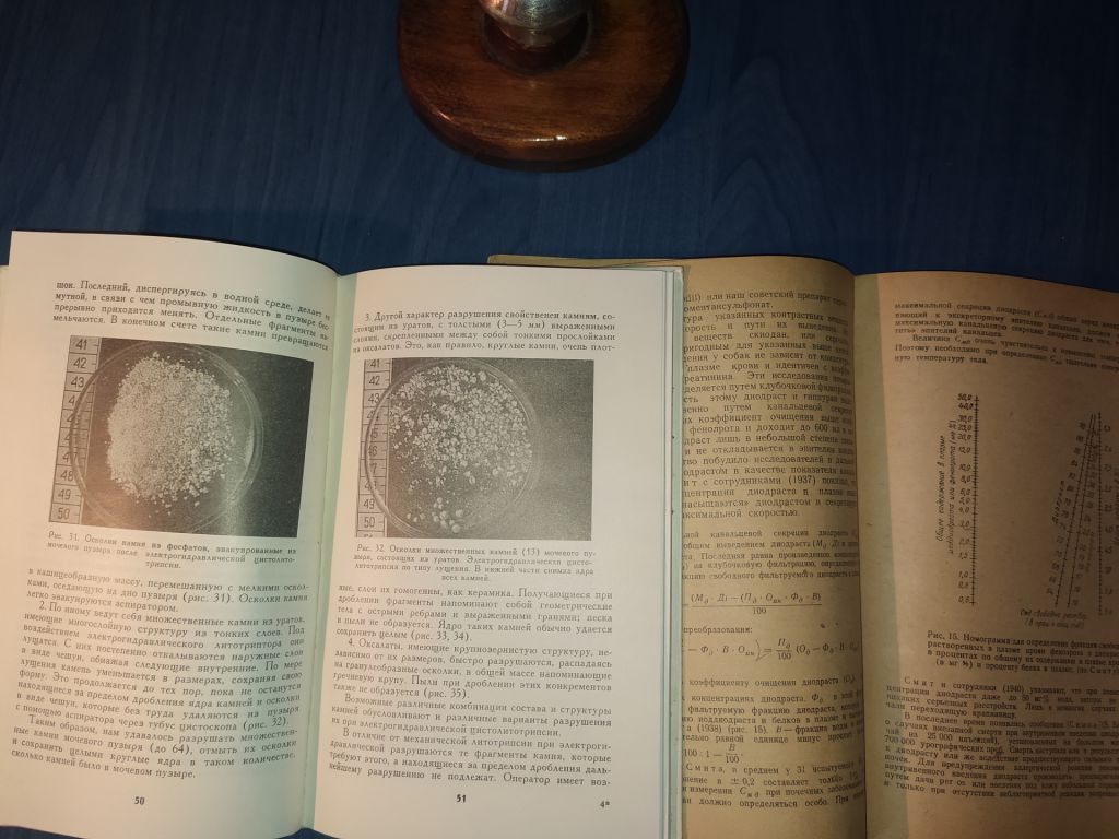 книги: ЭЛЕКТРОГИДРАВЛИЧЕСКАЯ ЦИСТОЛИТОТРИПСИЯ 1975г.; ФИЗИОЛОГИЯ ПОЧЕК 1949г.; ПОРОКИ СЕРДЦА 1932г.; - фото фото фото 6