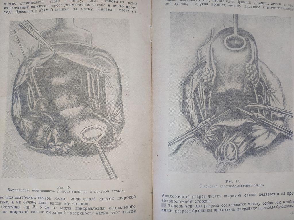 книга: ПРОФИЛАКТИКА, КЛИНИКА И ТЕРАПИЯ РАКА МАТКИ 1947г. - фото фото фото 11