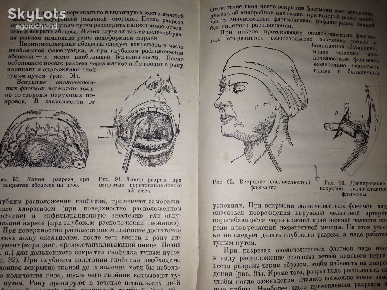 книга: БОЛЕЗНИ ЗУБОВ, ЧЕЛЮСТЕЙ И РТА 1949г. - фото фото фото 13