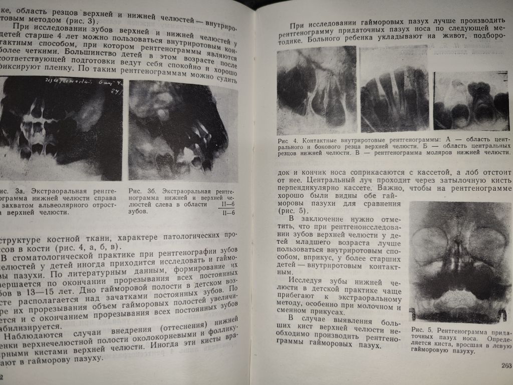 книга: ВОПРОСЫ ТЕРАПЕВТИЧЕСКОЙ СТОМАТОЛОГИИ ДЕТСКОГО ВОЗРАСТА 1968г. - фото фото фото 7