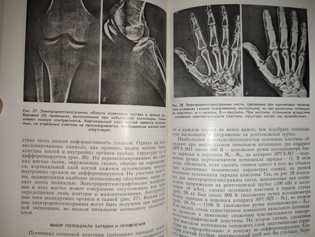 книга: МЕТОДИКА И ТЕХНИКА ЭЛЕКТРОРЕНТГЕНОГРАФИИ 1982г. - фото фото фото 7