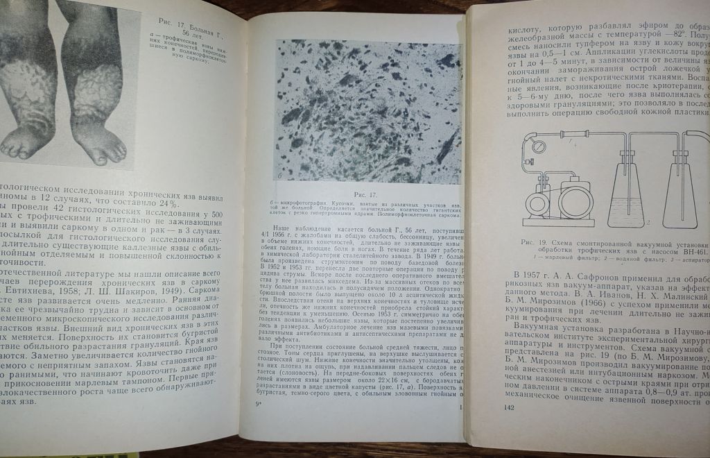 книги: ТРОФИЧЕСКИЕ ЯЗВЫ. ПАТОГЕНЕЗ, КЛИНИКА, ЛЕЧЕНИЕ 1972г. - фото фото фото 5