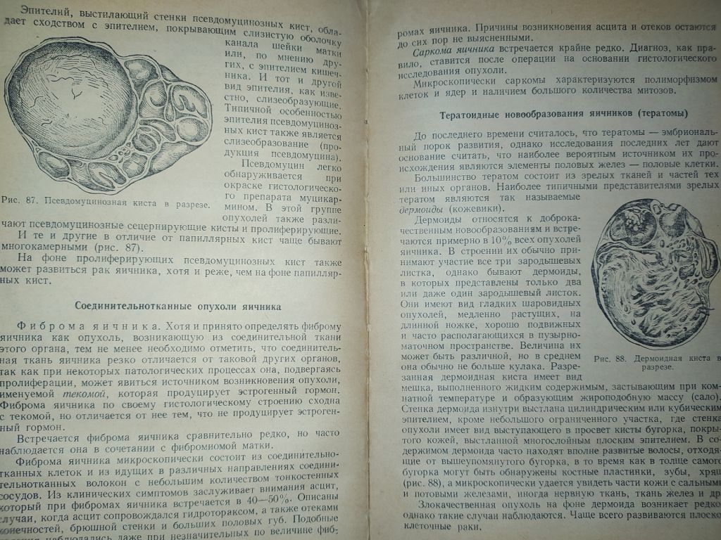 книга: УЧЕБНИК ГИНЕКОЛОГИИ. изд. V-e 1956г. - фото фото фото 6