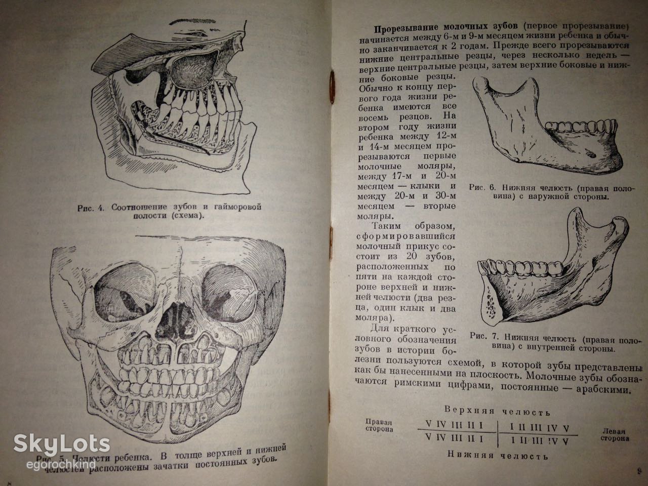 книга: БОЛЕЗНИ ЗУБОВ, ЧЕЛЮСТЕЙ И РТА 1949г. - фото фото фото 5