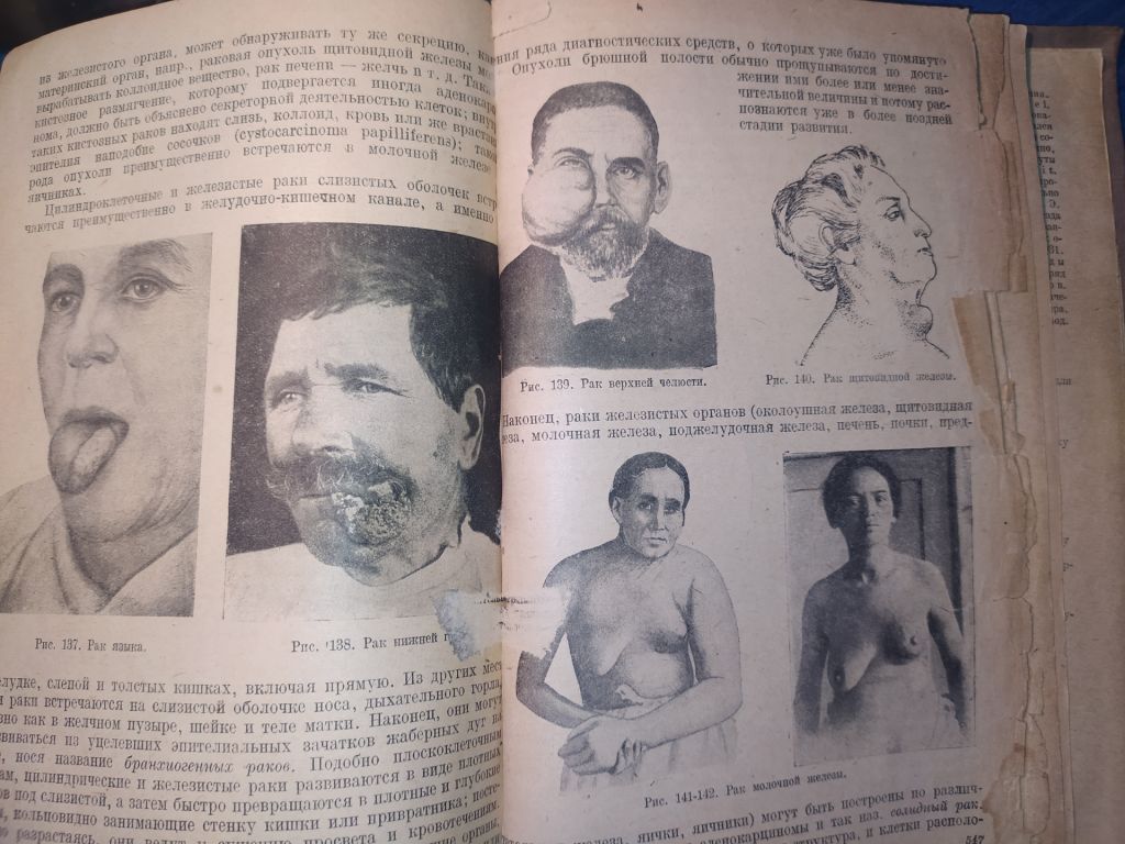 Книга: КУРС ОБЩЕЙ ХИРУРГИИ 1935г.; - фото фото фото 7