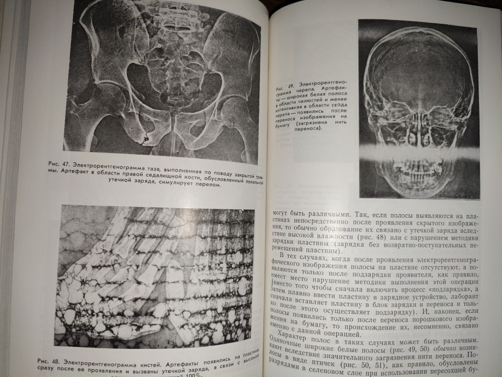книга: МЕТОДИКА И ТЕХНИКА ЭЛЕКТРОРЕНТГЕНОГРАФИИ 1982г. - фото фото фото 5