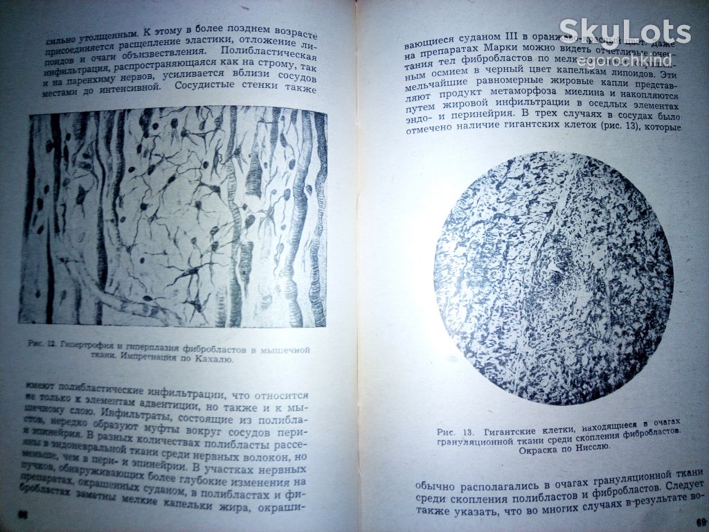 книга: ИШЕМИЧЕСКИЕ ЗАБОЛЕВАНИЯ НЕРВНЫХ СТВОЛОВ 1945г.; - фото фото фото 5
