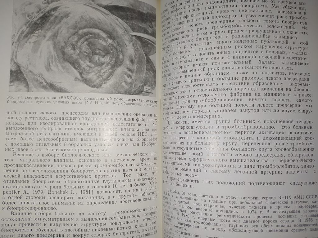 книга: БИОЛОГИЧЕСКИЕ ПРОТЕЗЫ КЛАПАНОВ СЕРДЦА 1988г. - фото фото фото 7
