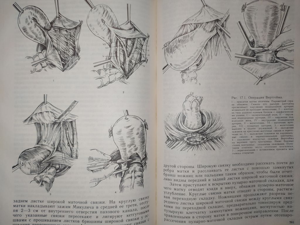книга: ОПЕРАТИВНАЯ ГИНЕКОЛОГИЯ. Руководство для врачей 1990г. - фото фото фото 6